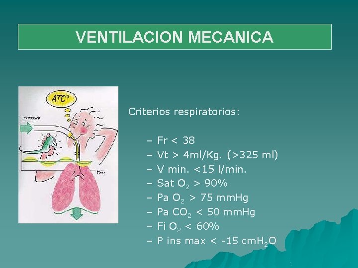 VENTILACION MECANICA Criterios respiratorios: – – – – Fr < 38 Vt > 4