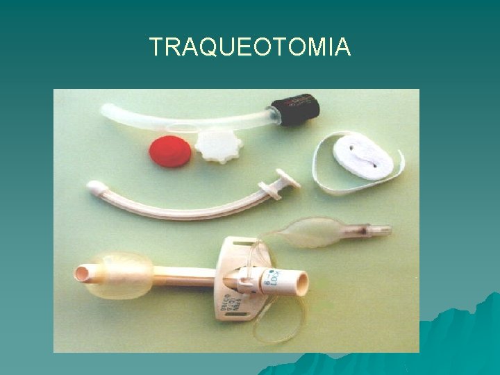 TRAQUEOTOMIA 