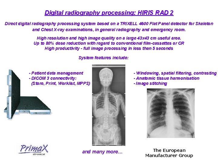 Digital radiography processing: HIRIS RAD 2 Direct digital radiography processing system based on a