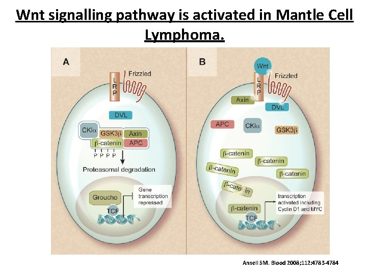 Wnt signalling pathway is activated in Mantle Cell Lymphoma. Ansell SM. Blood 2008; 112: