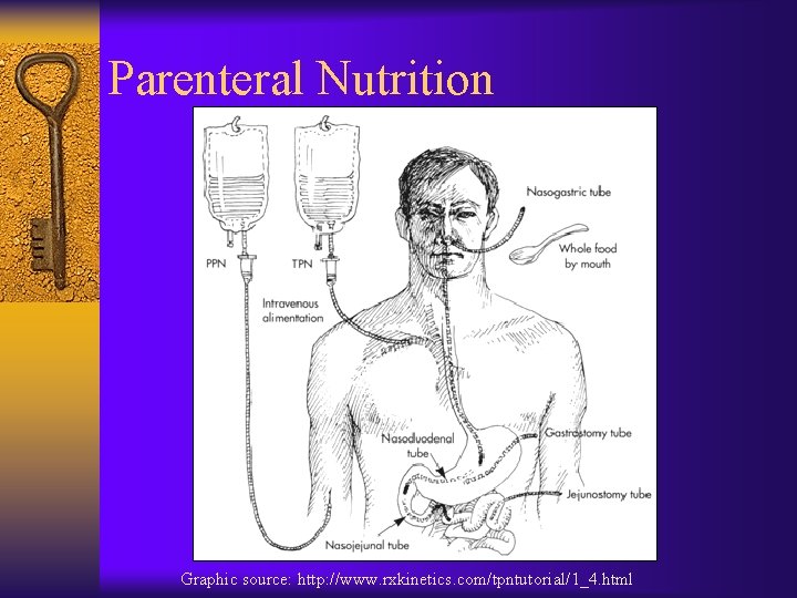 Parenteral Nutrition Graphic source: http: //www. rxkinetics. com/tpntutorial/1_4. html 