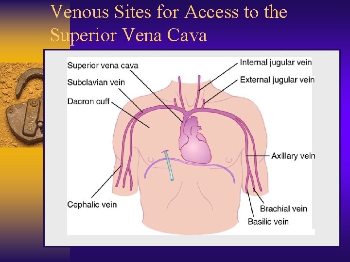 Venous Sites for Access to the Superior Vena Cava 