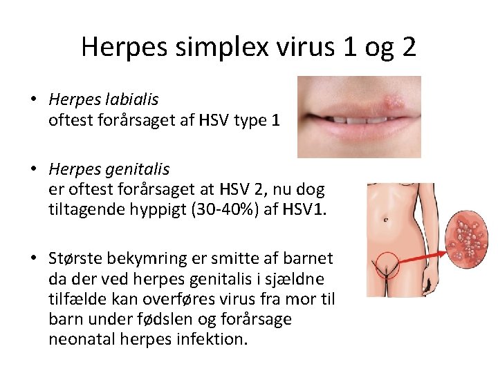 Ansteckung genitalis Herpes Genitalis