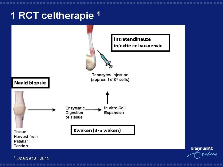 1 RCT celtherapie 1 Intratendineuze injectie cel suspensie Naald biopsie Kweken (3 -5 weken)