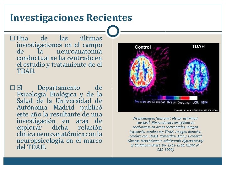 Investigaciones Recientes � Una de las últimas investigaciones en el campo de la neuroanatomía