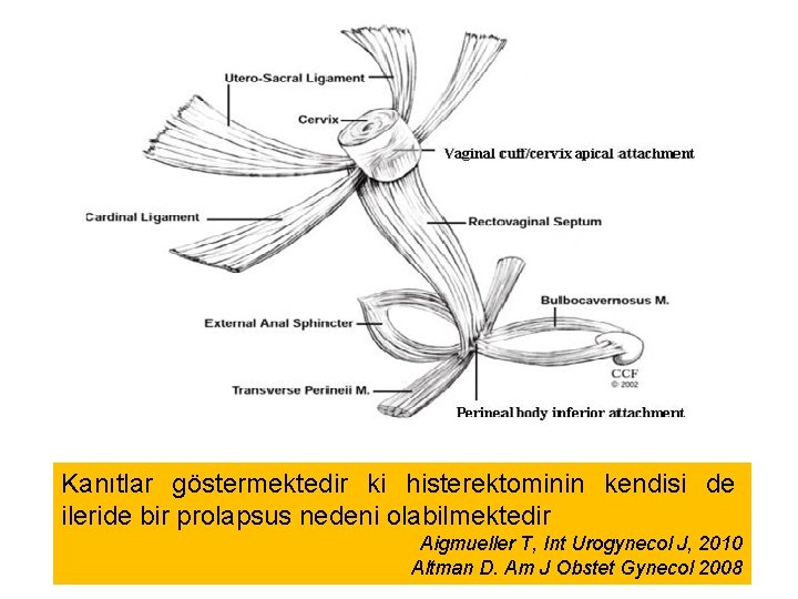 Kanıtlar göstermektedir ki histerektominin kendisi de ileride bir prolapsus nedeni olabilmektedir Aigmueller T, Int Kanıtlar göstermektedir ki histerektominin kendisi de ileride bir prolapsus nedeni olabilmektedir Aigmueller T, Int