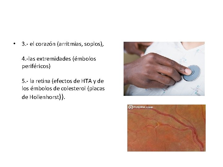  • 3. - el corazón (arritmias, soplos), 4. -las extremidades (émbolos periféricos) 5.