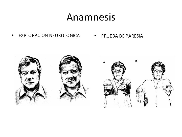 Anamnesis • EXPLORACION NEUROLOGICA • PRUEBA DE PARESIA 