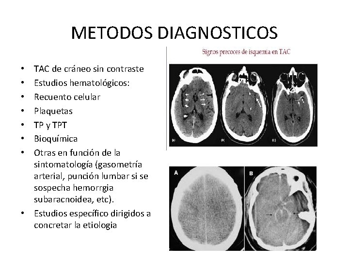 METODOS DIAGNOSTICOS TAC de cráneo sin contraste Estudios hematológicos: Recuento celular Plaquetas TP y