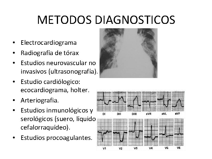 METODOS DIAGNOSTICOS • Electrocardiograma • Radiografía de tórax • Estudios neurovascular no invasivos (ultrasonografía).