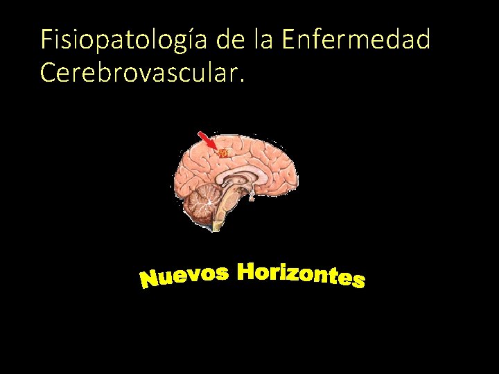 Fisiopatología de la Enfermedad Cerebrovascular. 