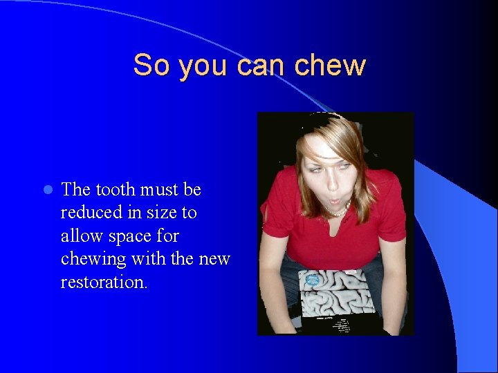 So you can chew l The tooth must be reduced in size to allow