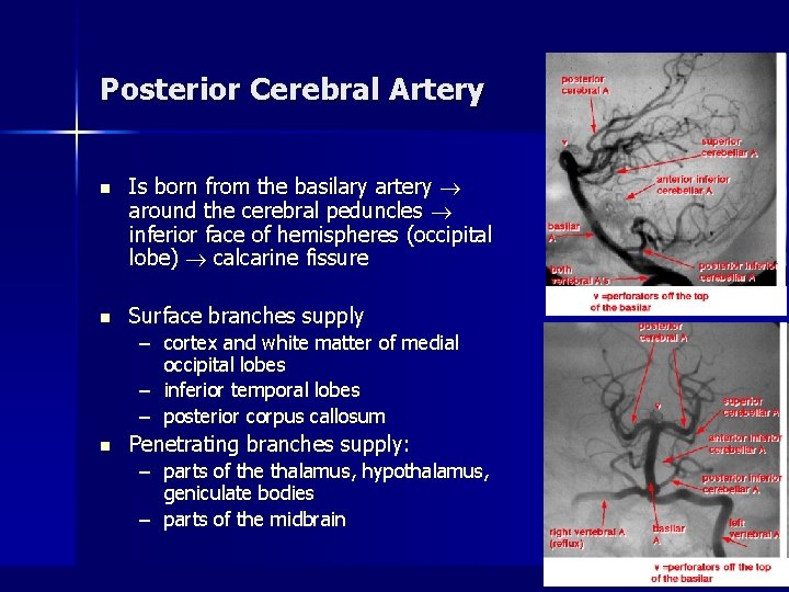 Posterior Cerebral Artery n Is born from the basilary artery around the cerebral peduncles