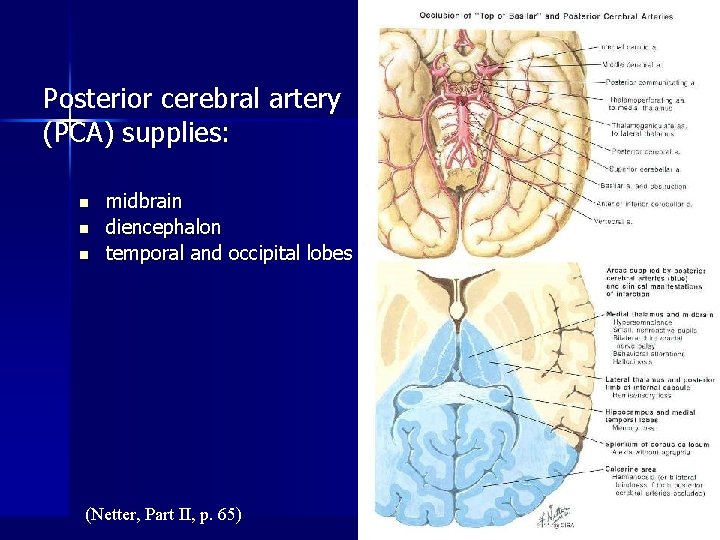 Posterior cerebral artery (PCA) supplies: n n n midbrain diencephalon temporal and occipital lobes