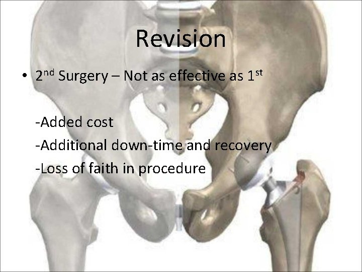 Revision • 2 nd Surgery – Not as effective as 1 st -Added cost