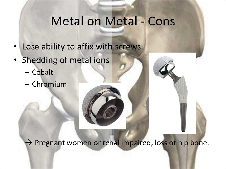 Metal on Metal - Cons • Lose ability to affix with screws. • Shedding