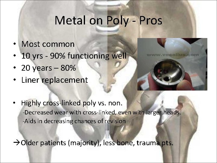 Metal on Poly - Pros • • Most common 10 yrs - 90% functioning
