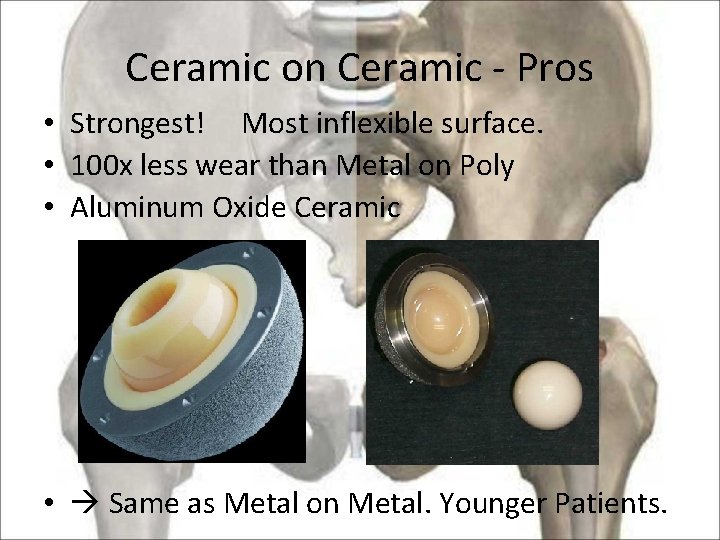 Ceramic on Ceramic - Pros • Strongest! Most inflexible surface. • 100 x less