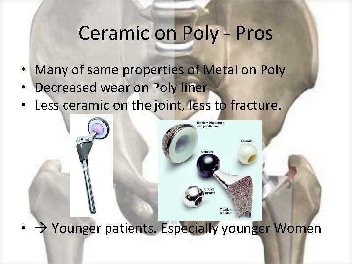 Ceramic on Poly - Pros • Many of same properties of Metal on Poly