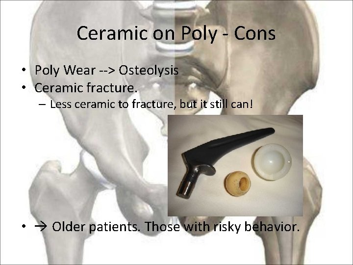Ceramic on Poly - Cons • Poly Wear --> Osteolysis • Ceramic fracture. –