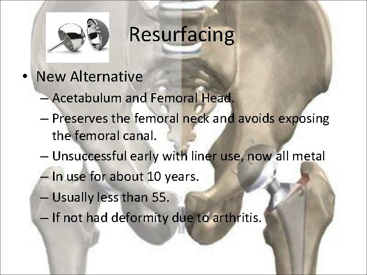 Resurfacing • New Alternative – Acetabulum and Femoral Head. – Preserves the femoral neck