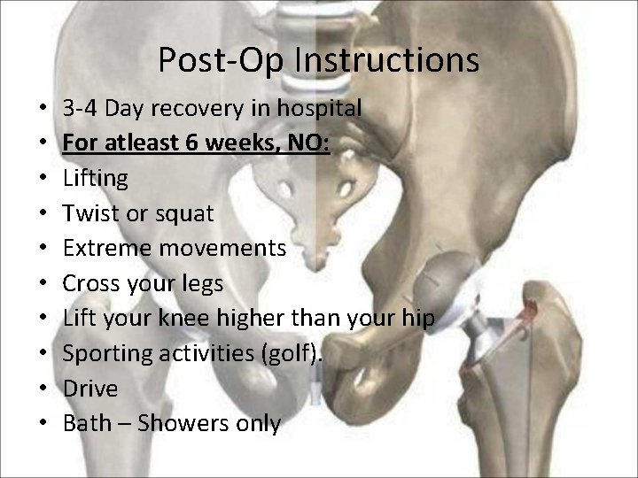 Post-Op Instructions • • • 3 -4 Day recovery in hospital For atleast 6
