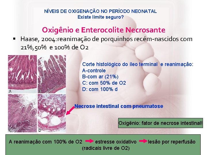 NÍVEIS DE OXIGENAÇÃO NO PERÍODO NEONATAL Existe limite seguro? Oxigênio e Enterocolite Necrosante §