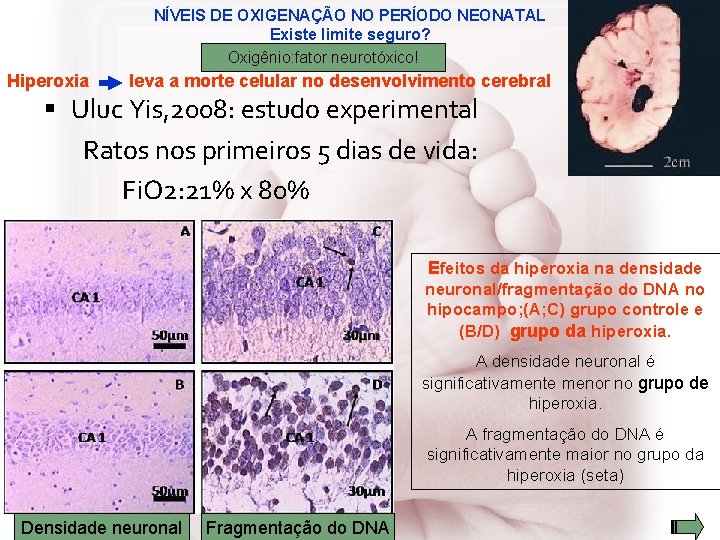 NÍVEIS DE OXIGENAÇÃO NO PERÍODO NEONATAL Existe limite seguro? Oxigênio: fator neurotóxico! Hiperoxia leva