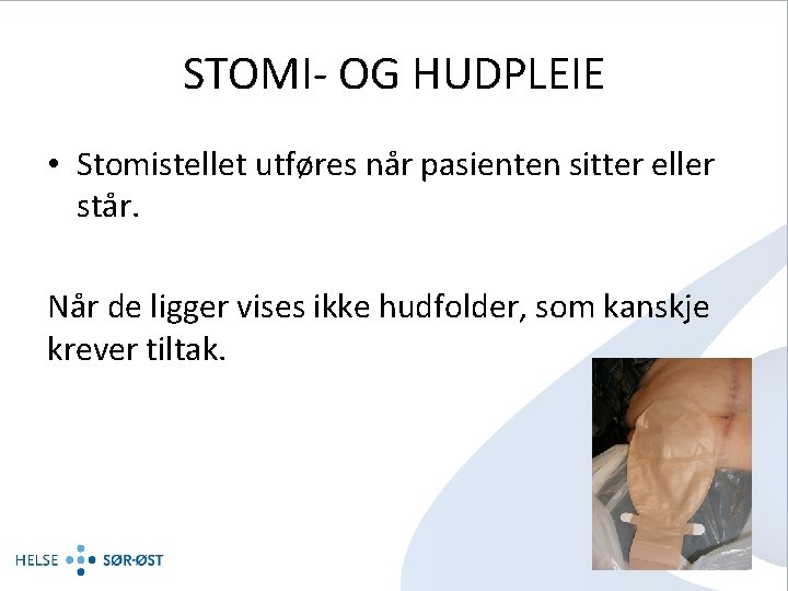 STOMI- OG HUDPLEIE • Stomistellet utføres når pasienten sitter eller står. Når de ligger