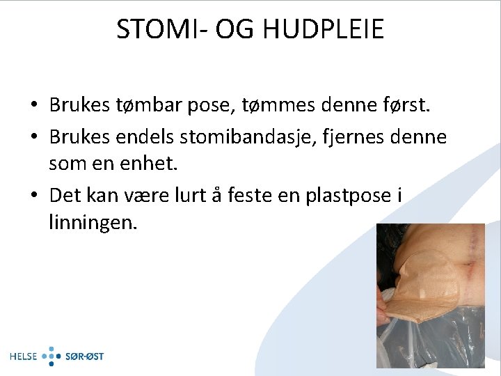 STOMI- OG HUDPLEIE • Brukes tømbar pose, tømmes denne først. • Brukes endels stomibandasje,