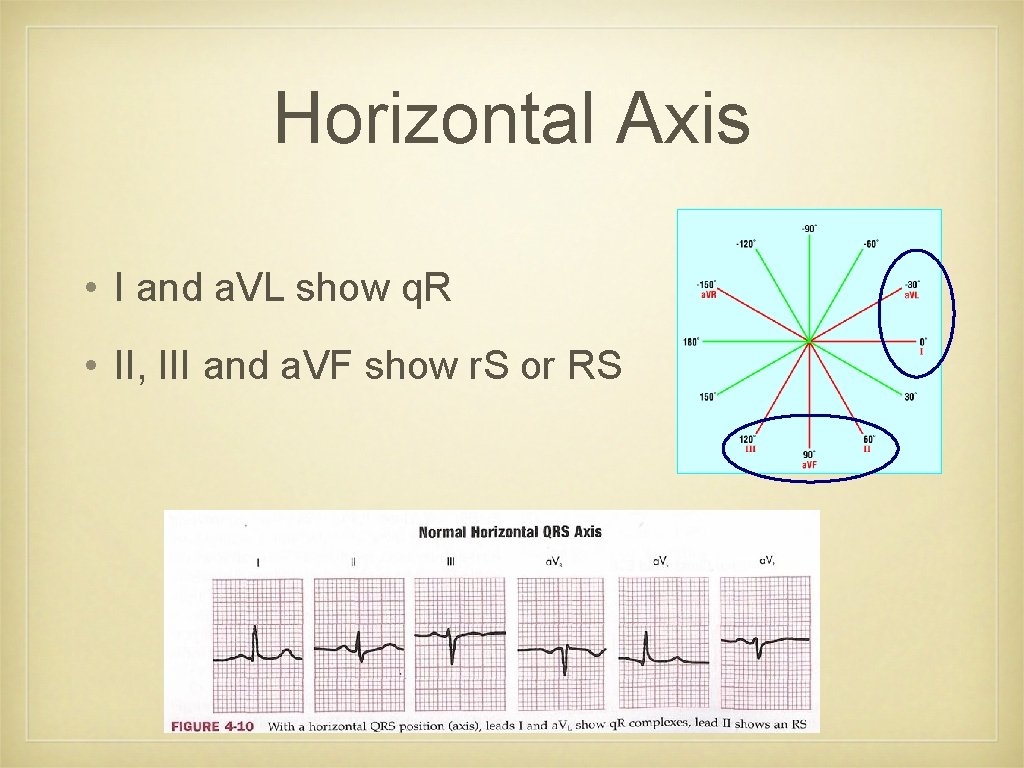 Horizontal Axis • I and a. VL show q. R • II, III and