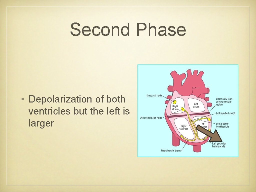 Second Phase • Depolarization of both ventricles but the left is larger 