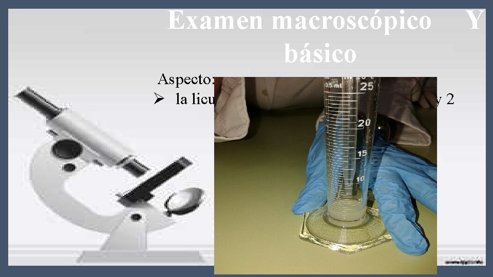 Examen macroscópico básico Aspecto: Ø la licuefacción: normal del paciente 1 y 2 Y