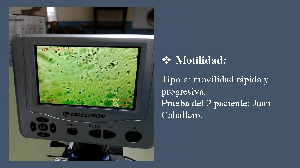 v Motilidad: Tipo a: movilidad rápida y progresiva. Prueba del 2 paciente: Juan Caballero.