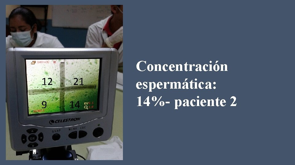 12 9 21 14 Concentración espermática: 14%- paciente 2 