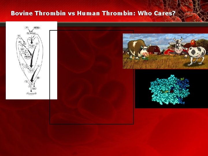 Bovine Thrombin vs Human Thrombin: Who Cares? 