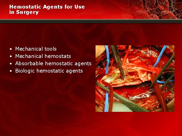 Hemostatic Agents for Use in Surgery • • Mechanical tools Mechanical hemostats Absorbable hemostatic
