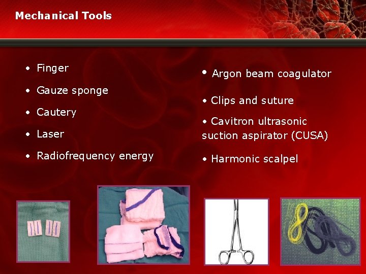 Mechanical Tools • Finger • Gauze sponge • Cautery • Argon beam coagulator •