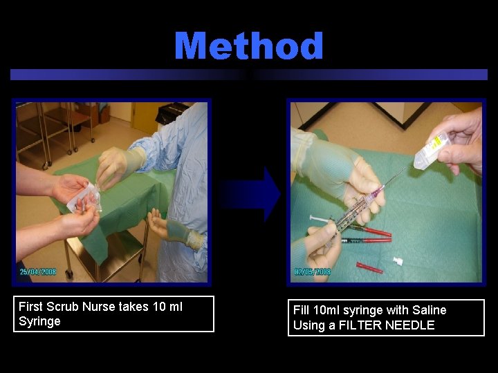 Method First Scrub Nurse takes 10 ml Syringe Fill 10 ml syringe with Saline