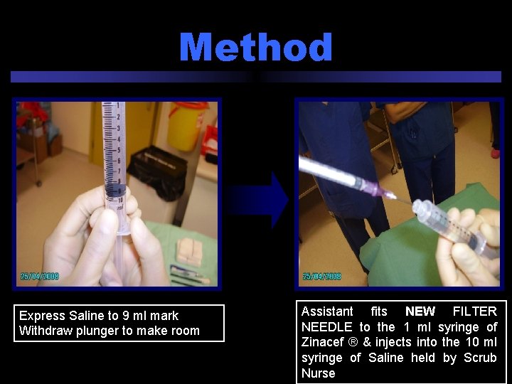 Method Express Saline to 9 ml mark Withdraw plunger to make room Assistant fits
