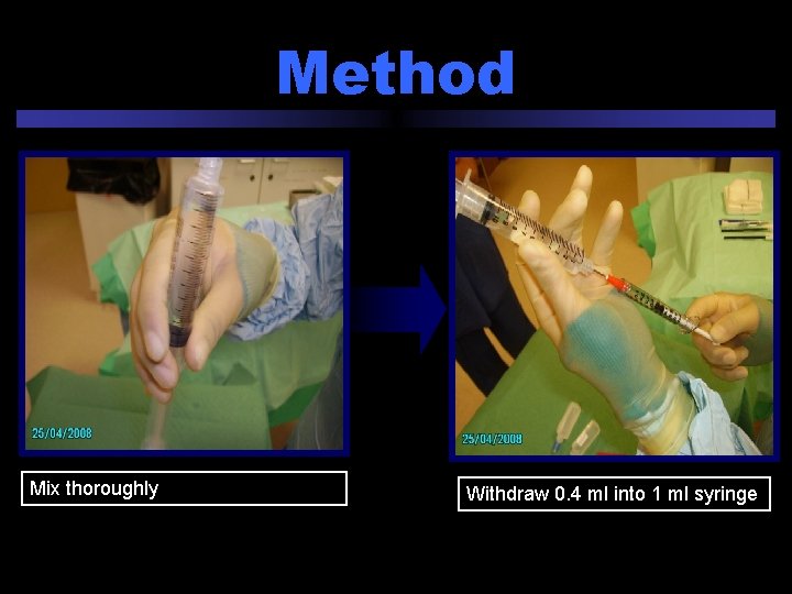 Method Mix thoroughly Withdraw 0. 4 ml into 1 ml syringe 