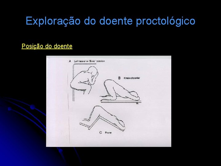 Exploração do doente proctológico Posição do doente 