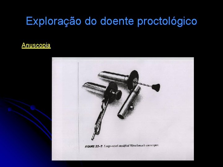 Exploração do doente proctológico Anuscopia 