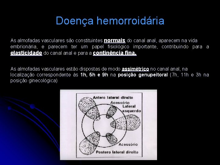 Doença hemorroidária As almofadas vasculares são constituintes normais do canal, aparecem na vida embrionária,