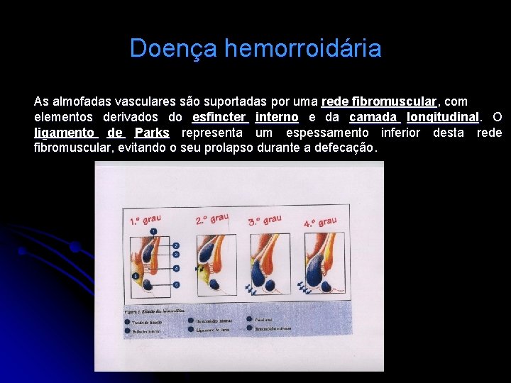 Doença hemorroidária As almofadas vasculares são suportadas por uma rede fibromuscular, com elementos derivados