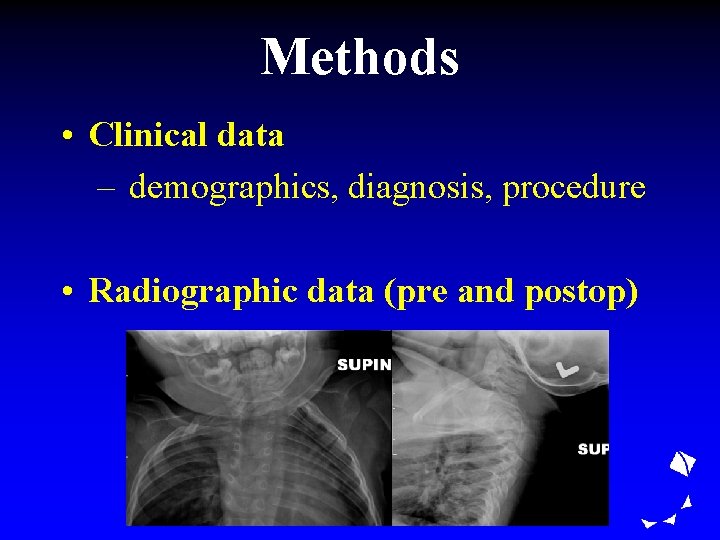 Methods • Clinical data – demographics, diagnosis, procedure • Radiographic data (pre and postop)