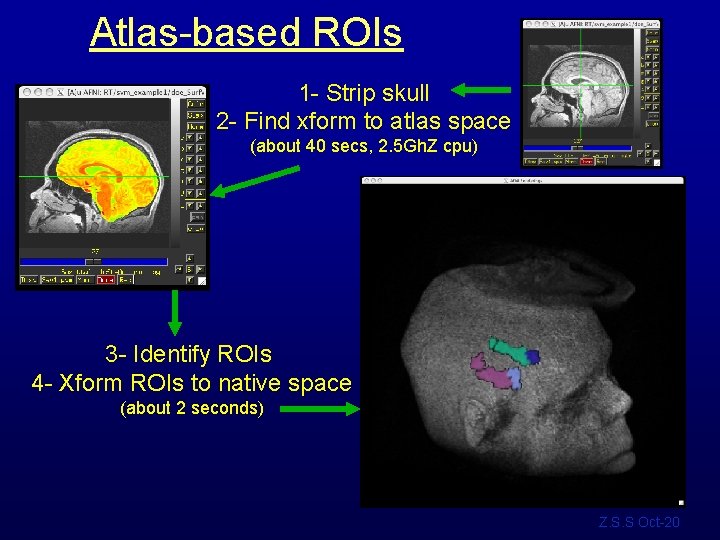 Atlas-based ROIs 1 - Strip skull 2 - Find xform to atlas space (about