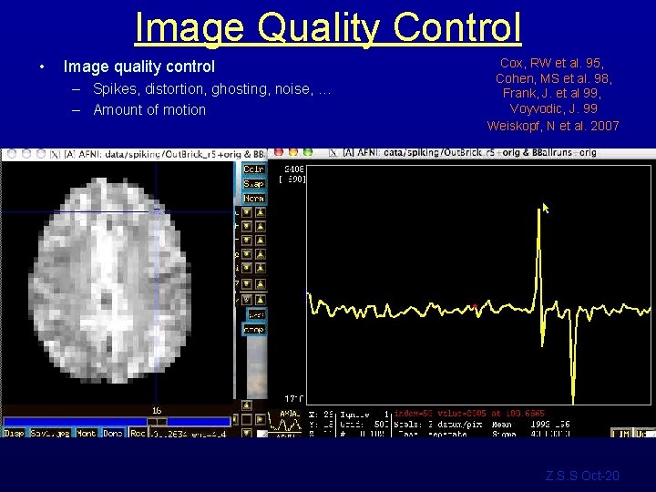 Image Quality Control • Image quality control – Spikes, distortion, ghosting, noise, … –
