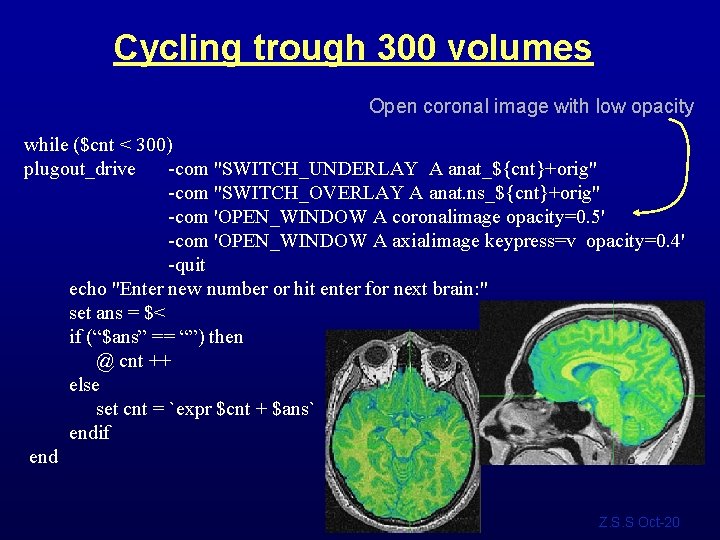 Cycling trough 300 volumes Open coronal image with low opacity while ($cnt < 300)