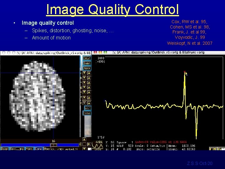 Image Quality Control • Image quality control – Spikes, distortion, ghosting, noise, … –